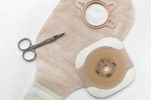 Día Mundial del Paciente Ostomizado, reivindicaciones e iniciativas